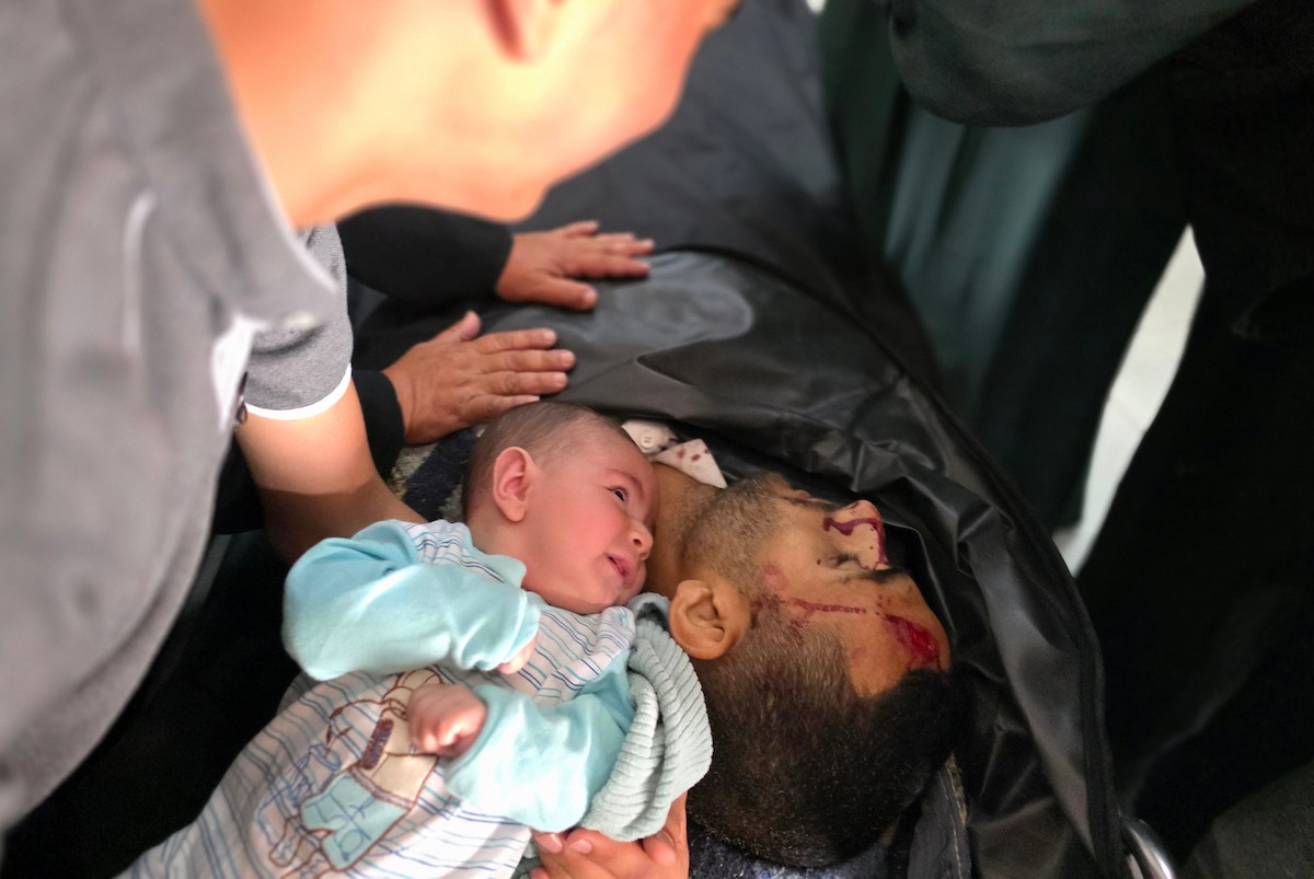 فلسطينيون ينقلون جثمان شاب وعدداً من الجرحى إلى مجمع ناصر الطبي، عقب غارة إسرائيلية استهدفت مجموعة من المدنيين في خان يونس جنوب قطاع غزة، في 18 مايو/أيار 2026. الصورة: طارق محمد