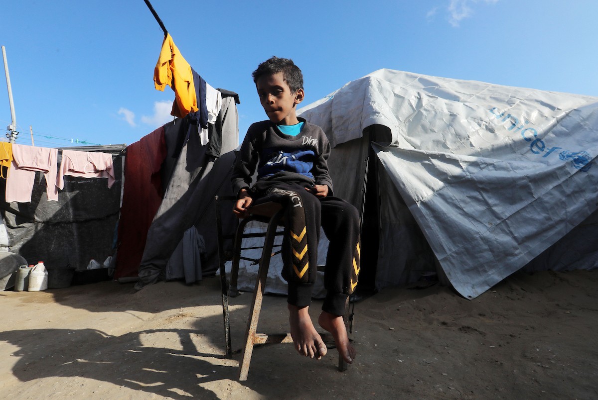 الطفل الفلسطيني محمد أحمد مسعود السوسي، 10 أعوام، داخل خيمة في مدينة غزة، في 6 مايو/أيار 2026، حيث يعاني من سوء التغذية ويحتاج إلى علاج طبي عاجل. تصوير: بلال أسامة