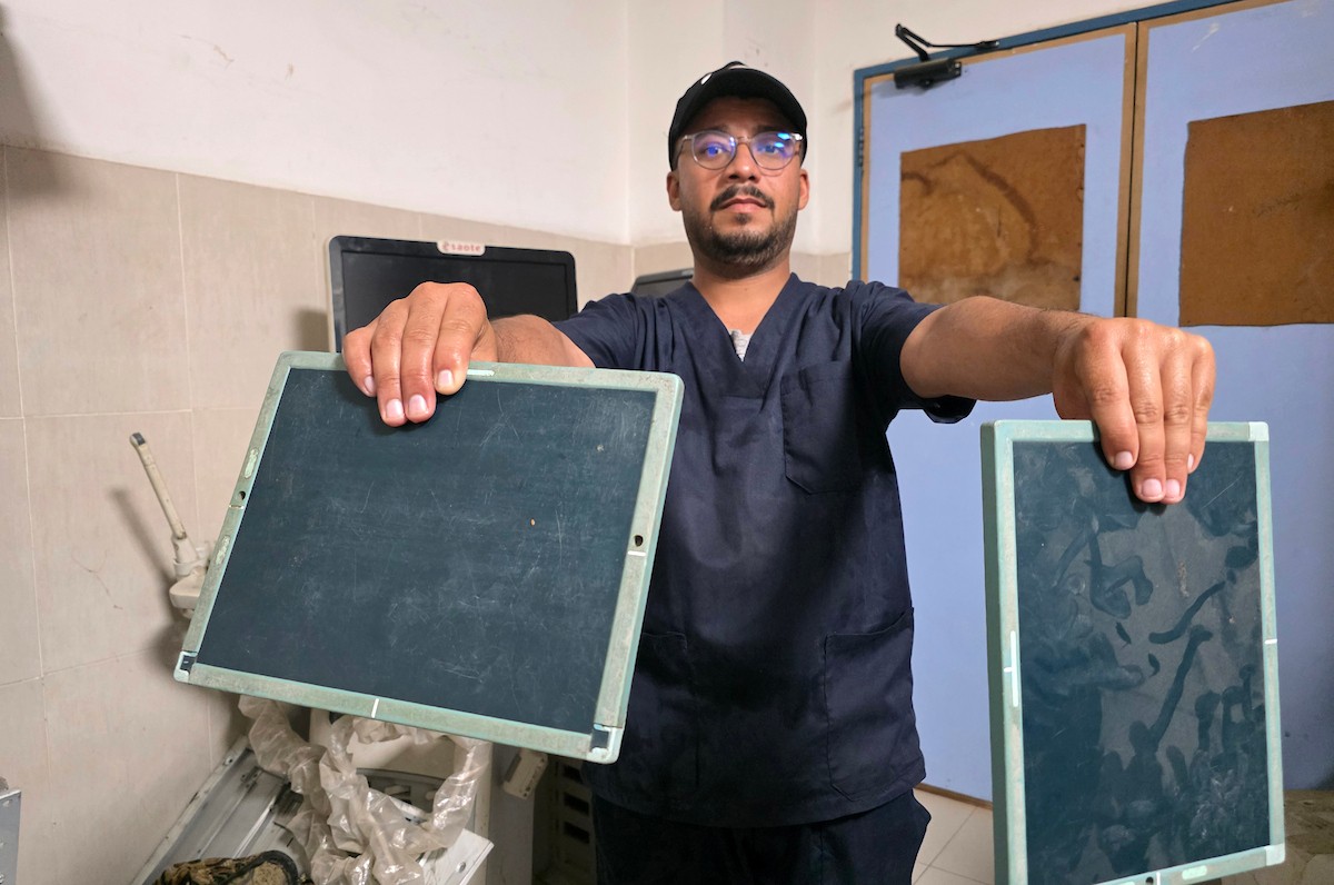 أطباء فلسطينيون يواصلون علاج وتشخيص المرضى والجرحى بإمكانيات محدودة في مجمع ناصر الطبي بخان يونس، جنوب قطاع غزة، في 20 أيار/ مايو 2026، وسط تحذيرات من تعطل معظم أجهزة التصوير الطبي ونقص أدوات التشخيص الأساسية. تصوير: طارق محمد.