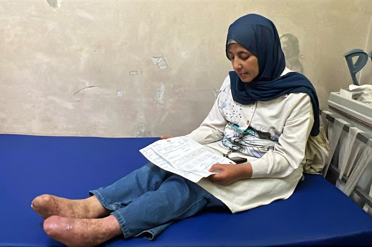 أفراد من عائلة الفلسطيني ياسر عماد ديب يتلقون العلاج في مستشفى شهداء الأقصى بدير البلح وسط قطاع غزة، في 12 مايو/أيار 2026، بعد نحو عام على إصابتهم في هجوم إسرائيلي قرب خيمتهم غرب المدينة، ما تسبب بحروق وبتر أطراف وإعاقات دائمة. تصوير: يوسف أبو وطفة
