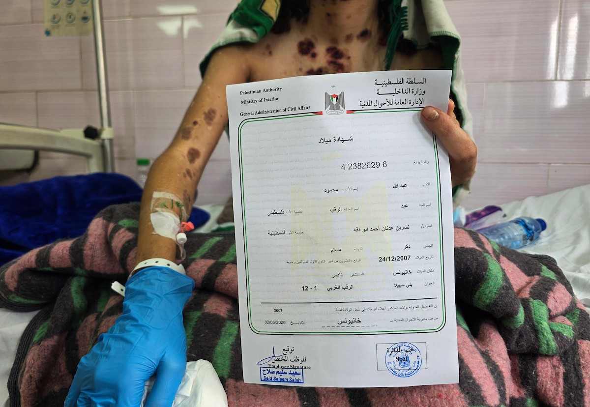 عبد الله الرقب يتلقى العلاج في مستشفى ناصر بخان يونس، جنوب قطاع غزة، في 2 مايو/أيار 2026.