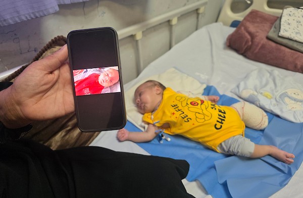 الطفل الفلسطيني محمد أحمد الخطيب، البالغ من العمر شهراً ونصف الشهر، يتلقى العلاج في مجمع ناصر الطبي بخان يونس بعد فقدانه إحدى قدميه وإصابة يده في غارة إسرائيلية أودت بحياة والدته، 4 حزيران/يونيو 2026. تصوير: طارق محمد.