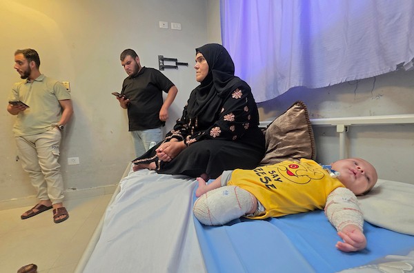 الطفل الفلسطيني محمد أحمد الخطيب، البالغ من العمر شهراً ونصف الشهر، يتلقى العلاج في مجمع ناصر الطبي بخان يونس بعد فقدانه إحدى قدميه وإصابة يده في غارة إسرائيلية أودت بحياة والدته، 4 حزيران/يونيو 2026. تصوير: طارق محمد.