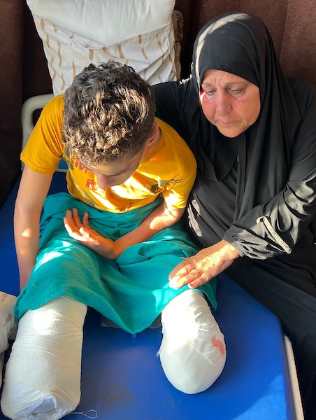 الطفل محمد سرور يتلقى العلاج في مستشفى شهداء الأقصى بدير البلح، وسط قطاع غزة، في 2 يونيو/حزيران 2026، بعد إصابته بانفجار جسم من مخلفات الجيش الإسرائيلي خلال الحرب، ما أدى إلى بتر قدميه وفقدان عينه اليسرى وإصابته بشلل في يده اليسرى.  تصوير: يوسف أبو وطفة