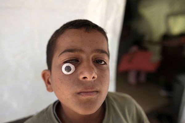 الطفل محمد الجرجاوي، 12 عاماً، يجلس داخل خيمة مع عائلته النازحة في مدينة غزة، بعد أن فقد إحدى عينيه أثناء فراره من شمال القطاع. تصوير: بلال أسامة