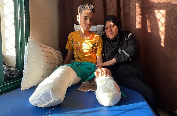الطفل محمد سرور يتلقى العلاج في مستشفى شهداء الأقصى بدير البلح، وسط قطاع غزة، في 2 يونيو/حزيران 2026، بعد إصابته بانفجار جسم من مخلفات الجيش الإسرائيلي خلال الحرب، ما أدى إلى بتر قدميه وفقدان عينه اليسرى وإصابته بشلل في يده اليسرى.  تصوير: يوسف أبو وطفة