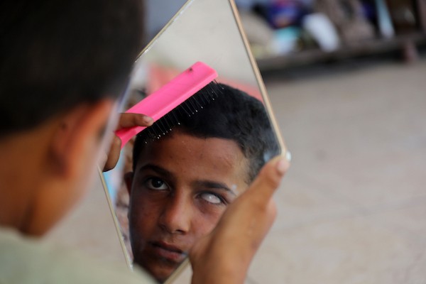 الطفل محمد الجرجاوي، 12 عاماً، يجلس داخل خيمة مع عائلته النازحة في مدينة غزة، بعد أن فقد إحدى عينيه أثناء فراره من شمال القطاع. تصوير: بلال أسامة