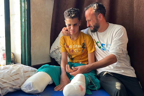 الطفل محمد سرور يتلقى العلاج في مستشفى شهداء الأقصى بدير البلح، وسط قطاع غزة، في 2 يونيو/حزيران 2026، بعد إصابته بانفجار جسم من مخلفات الجيش الإسرائيلي خلال الحرب، ما أدى إلى بتر قدميه وفقدان عينه اليسرى وإصابته بشلل في يده اليسرى.  تصوير: يوسف أبو وطفة