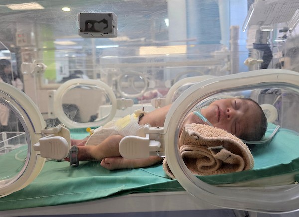 أطفال خدج  في مجمع ناصر الطبي بمدينة خان يونس يواجهون نقص الرعاية. 26 يونيو/حزيران 2026، بعدسة طارق محمد
