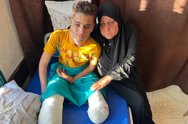 الطفل محمد سرور يتلقى العلاج في مستشفى شهداء الأقصى بدير البلح، وسط قطاع غزة، في 2 يونيو/حزيران 2026، بعد إصابته بانفجار جسم من مخلفات الجيش الإسرائيلي خلال الحرب، ما أدى إلى بتر قدميه وفقدان عينه اليسرى وإصابته بشلل في يده اليسرى.  تصوير: يوسف أبو وطفة