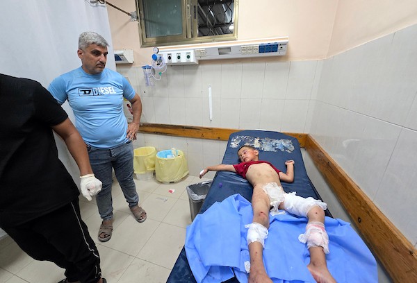 يتلقى فلسطينيون جرحى، بينهم أطفال، العلاج في مجمع ناصر الطبي في خان يونس، جنوب قطاع غزة، في 23 يوليو/تموز 2026.صورة: طارق محمد