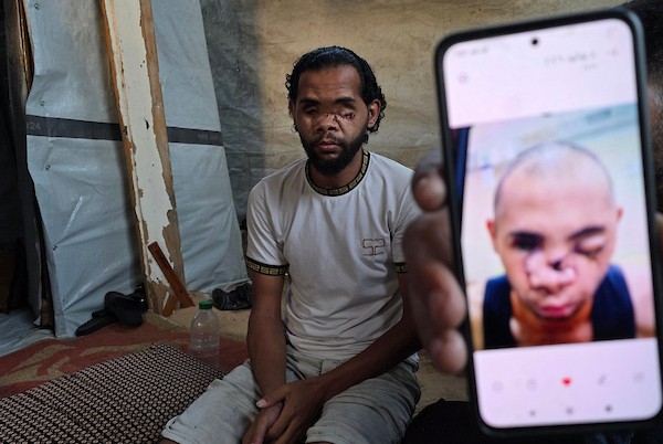 الشقيقان محمد دبور وموسى دبور داخل خيمة للنازحين في خان يونس، جنوب قطاع غزة، في 9 يوليو/تموز 2026. فقد محمد بصره بالكامل، فيما فقد موسى عينه اليسرى، إثر حادثة قرب مركز لتوزيع المساعدات في يوليو/تموز 2025 أودت بحياة شقيقهما حسين.(تصوير: طارق محمد)