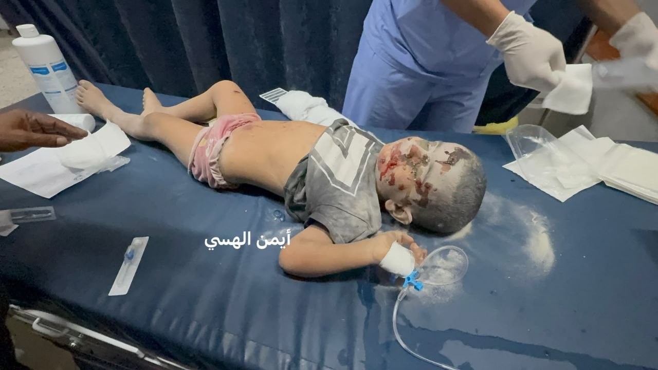 صول مجمع الشفاء الطبي اصابات جلهم من الأطفال اثر استهداف طائرة انتحارية شقة سكنية شمال ملعب فلسطين غرب مدينة غز.jpg