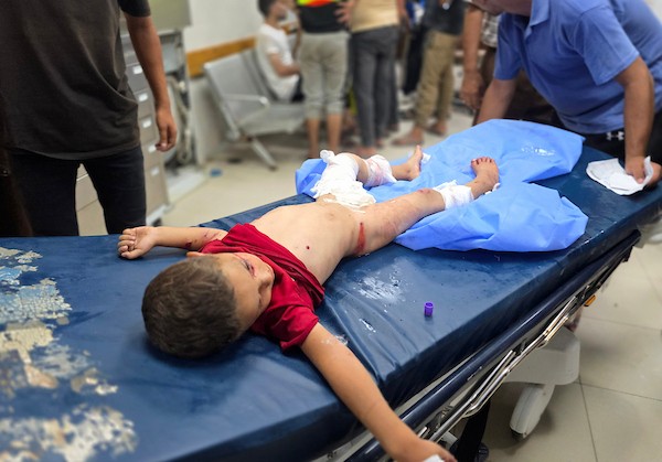 يتلقى فلسطينيون جرحى، بينهم أطفال، العلاج في مجمع ناصر الطبي في خان يونس، جنوب قطاع غزة، في 23 يوليو/تموز 2026.صورة: طارق محمد