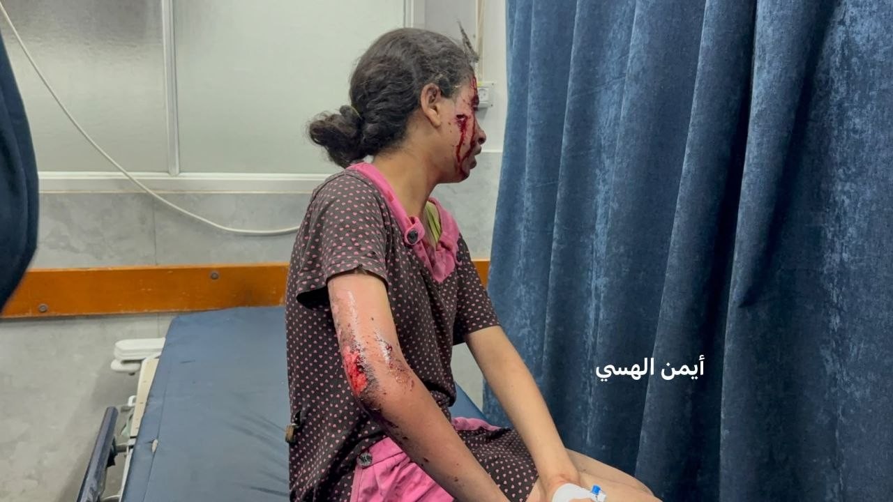 صول مجمع الشفاء الطبي اصابات جلهم من الأطفال اثر استهداف طائرة انتحارية شقة سكنية شمال ملعب فلسطين غرب مدينة غز...jpg