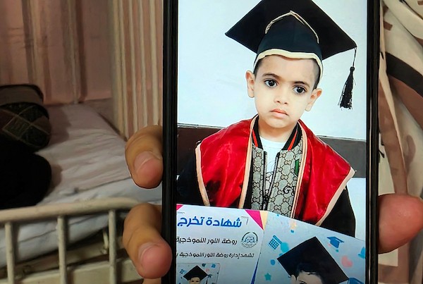 الفلسطينية إيمان أبو جامع تجلس إلى جانب طفلها ياسر عرفات، البالغ ست سنوات، أثناء تلقيه العلاج من سوء التغذية في مجمع ناصر الطبي بخان يونس، جنوب قطاع غزة، في 8 يوليو/تموز 2026. وتقول الأم إنها فقدت زوجها وابنًا آخر بسبب مضاعفات سوء التغذية. تصوير: طارق محمد