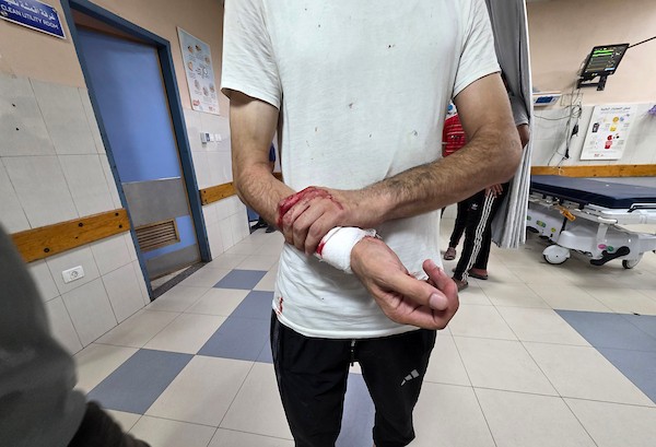 يتلقى فلسطينيون جرحى، بينهم أطفال، العلاج في مجمع ناصر الطبي في خان يونس، جنوب قطاع غزة، في 23 يوليو/تموز 2026.صورة: طارق محمد