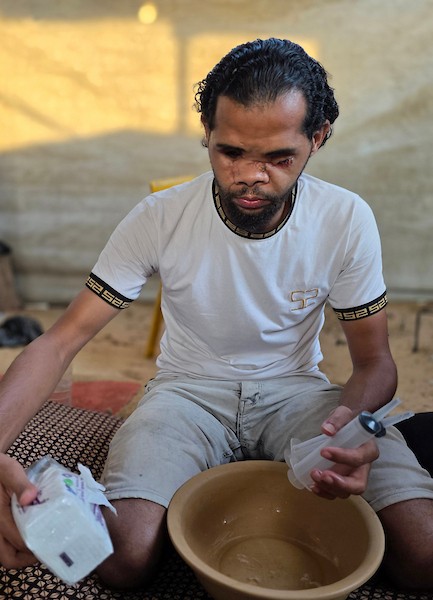 الشقيقان محمد دبور وموسى دبور داخل خيمة للنازحين في خان يونس، جنوب قطاع غزة، في 9 يوليو/تموز 2026. فقد محمد بصره بالكامل، فيما فقد موسى عينه اليسرى، إثر حادثة قرب مركز لتوزيع المساعدات في يوليو/تموز 2025 أودت بحياة شقيقهما حسين.(تصوير: طارق محمد)