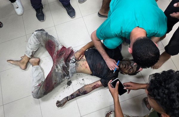 فلسطينيون ينقلون جثامين أربعة قتلى وعددًا من الجرحى، معظمهم من الأطفال، إلى مجمع ناصر الطبي في خان يونس جنوب قطاع غزة، في 8 يوليو/تموز 2026، بعد غارة إسرائيلية بطائرة مسيّرة استهدفت خيمة للنازحين جنوب المدينة، وفق مسعفين. تصوير: طارق محمد