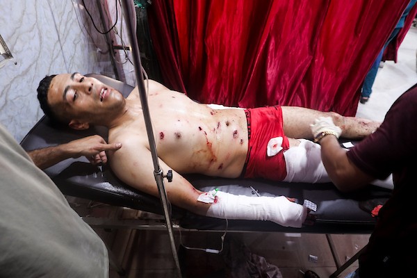 يتلقى فلسطينيون جرحى العلاج داخل مستشفى العودة في مخيم النصيرات للاجئين، وسط قطاع غزة، عقب غارة جوية إسرائيلية استهدفت مجموعة من الأشخاص في المخيم، في 28 يوليو/تموز 2026. صورة: معز صالحي