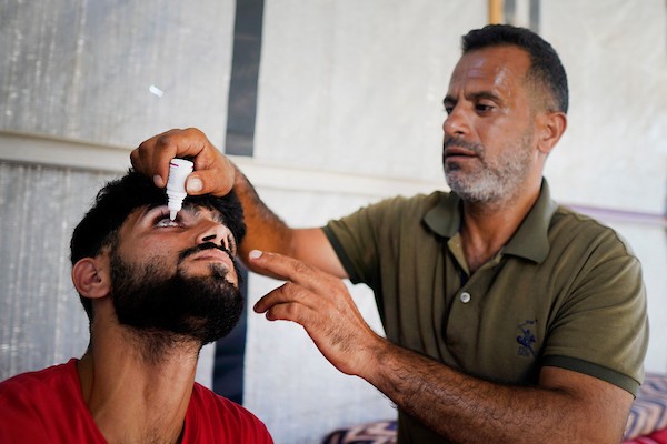 يقف الشاب الفلسطيني نبيل العرير، من حي الشجاعية شرقي مدينة غزة، لالتقاط صورة في 3 يوليو/تموز 2026، بعدما فقد إحدى عينيه وأصيبت الأخرى بجروح بالغة جراء غارة إسرائيلية سابقة استهدفت منزل عائلته.تصوير: محمد أبو القمصان