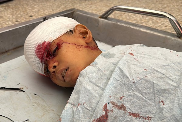 فلسطينيون يودّعون جثماني الطفل تيم حمدان (3 أعوام) والشاب حسام نصير في مستشفى شهداء الأقصى، عقب قصف إسرائيلي على دير البلح وسط قطاع غزة، 30 أغسطس/آب 2026. (تصوير: أحمد إبراهيم)