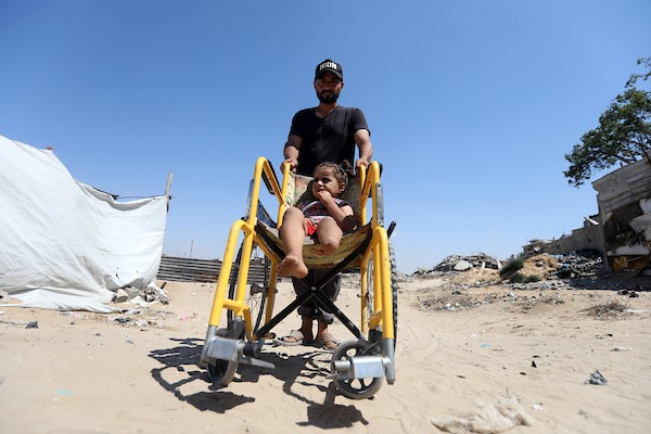 الطفلة جمالات علاء ضبان، ثلاث سنوات ونصف فقدت ساقها اليسرى في هجوم إسرائيلي شمال غزة في مايو/أيار الماضي، ولا تزال تنتظر تركيب طرف صناعي. صورة: بلال أسامة