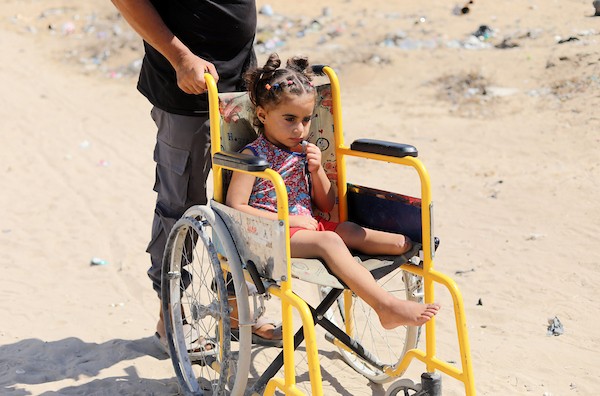 الطفلة جمالات علاء ضبان، ثلاث سنوات ونصف فقدت ساقها اليسرى في هجوم إسرائيلي شمال غزة في مايو/أيار الماضي، ولا تزال تنتظر تركيب طرف صناعي. صورة: بلال أسامة
