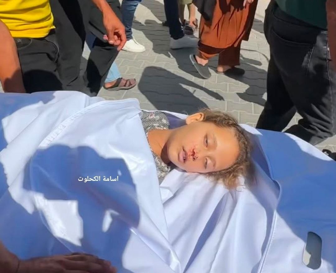 الطفلة امال ابو خاطر.jpg