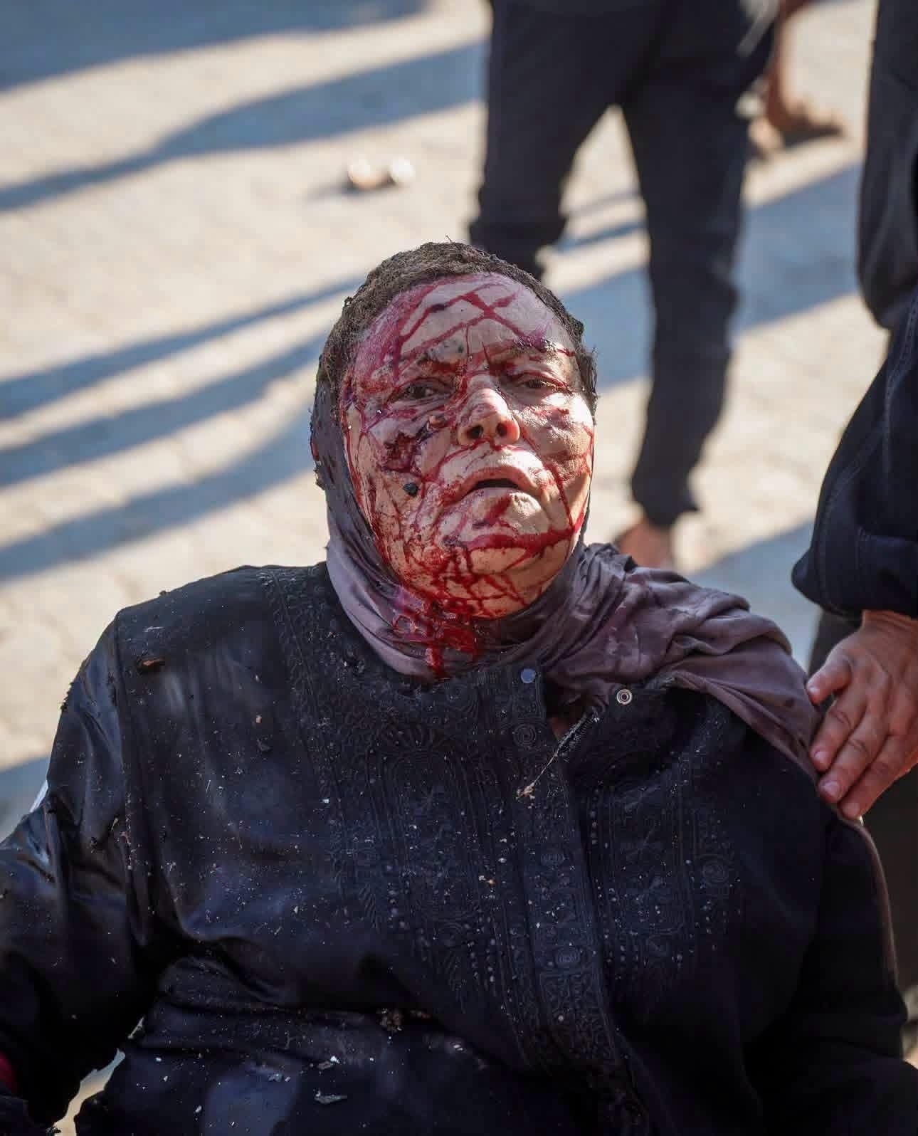 مشهد لمسنّة جريحة من مكان المجزرة التي ارتكبها الاحتلال بقصف مقهى على شاطئ مدينة غزة..jpg
