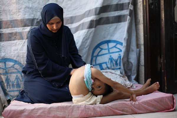 الطفلة سيلا أبو كريم، 6 أعوام، تجلس داخل منزل متضرر في مخيم المغازي وسط قطاع غزة، في 3 سبتمبر/أيلول 2026، بعدما تسببت شظايا غارة إسرائيلية سابقة بإصابات في فقرات ظهرها وعمودها الفقري. تصوير: حسن الجدي.