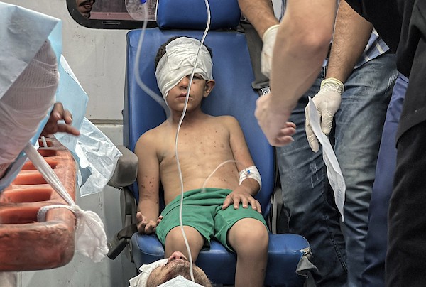 يُعالج المسعفون عدداً من الفلسطينيين الجرحى، معظمهم من الأطفال، في مستشفى العودة بمخيم النصيرات للاجئين، وسط قطاع غزة، في 16 سبتمبر/أيلول 2026.صورة: حسن الجدي