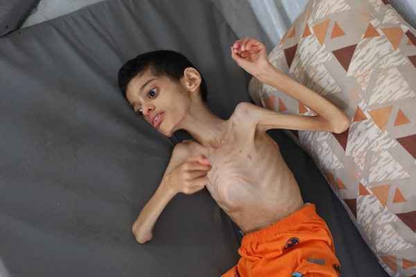الطفل إبراهيم أبو سرايا، 16 عامًا، داخل خيمة للنازحين في مخيم النصيرات وسط قطاع غزة، في 15 أيلول/سبتمبر 2026، بعدما تراجع وزنه إلى 7.5 كيلوغرامات وسط معاناته من الشلل الدماغي وسوء التغذية الحاد. تصوير: حسن الجدي