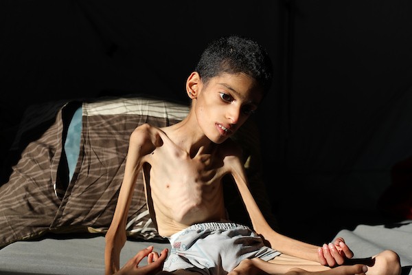 الطفل إبراهيم أبو سرايا، 16 عامًا، داخل خيمة للنازحين في مخيم النصيرات وسط قطاع غزة، في 15 أيلول/سبتمبر 2026، بعدما تراجع وزنه إلى 7.5 كيلوغرامات وسط معاناته من الشلل الدماغي وسوء التغذية الحاد. تصوير: حسن الجدي