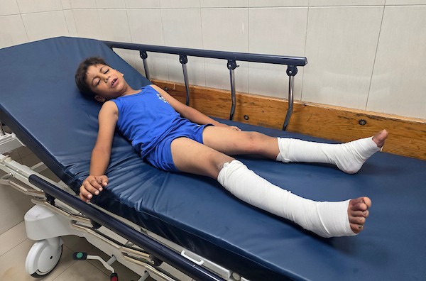يتلقى أطفال فلسطينيون جرحى العلاج في مجمع ناصر الطبي في خان يونس، جنوب قطاع غزة، في 10 سبتمبر/أيلول 2026. تصوير: طارق محمد