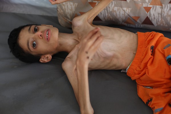 الطفل إبراهيم أبو سرايا، 16 عامًا، داخل خيمة للنازحين في مخيم النصيرات وسط قطاع غزة، في 15 أيلول/سبتمبر 2026، بعدما تراجع وزنه إلى 7.5 كيلوغرامات وسط معاناته من الشلل الدماغي وسوء التغذية الحاد. تصوير: حسن الجدي