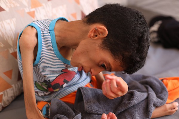 الطفل إبراهيم أبو سرايا، 16 عامًا، داخل خيمة للنازحين في مخيم النصيرات وسط قطاع غزة، في 15 أيلول/سبتمبر 2026، بعدما تراجع وزنه إلى 7.5 كيلوغرامات وسط معاناته من الشلل الدماغي وسوء التغذية الحاد. تصوير: حسن الجدي