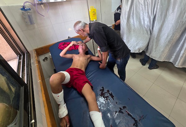 يتلقى أطفال فلسطينيون جرحى العلاج في مجمع ناصر الطبي في خان يونس، جنوب قطاع غزة، في 10 سبتمبر/أيلول 2026. تصوير: طارق محمد