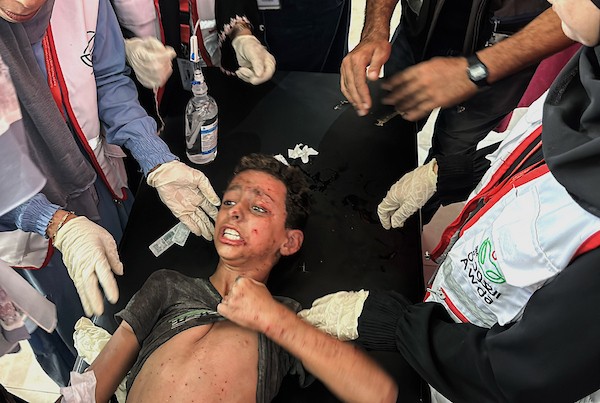 يُعالج المسعفون عدداً من الفلسطينيين الجرحى، معظمهم من الأطفال، في مستشفى العودة بمخيم النصيرات للاجئين، وسط قطاع غزة، في 16 سبتمبر/أيلول 2026.صورة: حسن الجدي