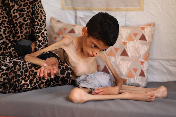 الطفل إبراهيم أبو سرايا، 16 عامًا، داخل خيمة للنازحين في مخيم النصيرات وسط قطاع غزة، في 15 أيلول/سبتمبر 2026، بعدما تراجع وزنه إلى 7.5 كيلوغرامات وسط معاناته من الشلل الدماغي وسوء التغذية الحاد. تصوير: حسن الجدي