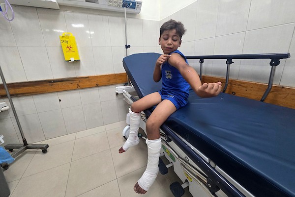 يتلقى أطفال فلسطينيون جرحى العلاج في مجمع ناصر الطبي في خان يونس، جنوب قطاع غزة، في 10 سبتمبر/أيلول 2026. تصوير: طارق محمد