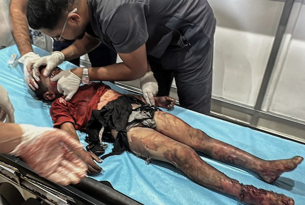 يُعالج المسعفون عدداً من الفلسطينيين الجرحى، معظمهم من الأطفال، في مستشفى العودة بمخيم النصيرات للاجئين، وسط قطاع غزة، في 16 سبتمبر/أيلول 2026.صورة: حسن الجدي