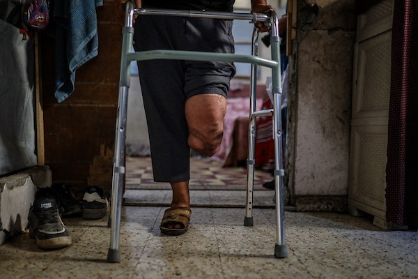 محمود فؤاد الدهشان (64 عامًا) يستعين بجهاز طبي للمشي في حي الزيتون بمدينة غزة، بعد فقدان قدمه اليسرى في قصف إسرائيلي عام 2023. (تصوير: بلال أسامة)