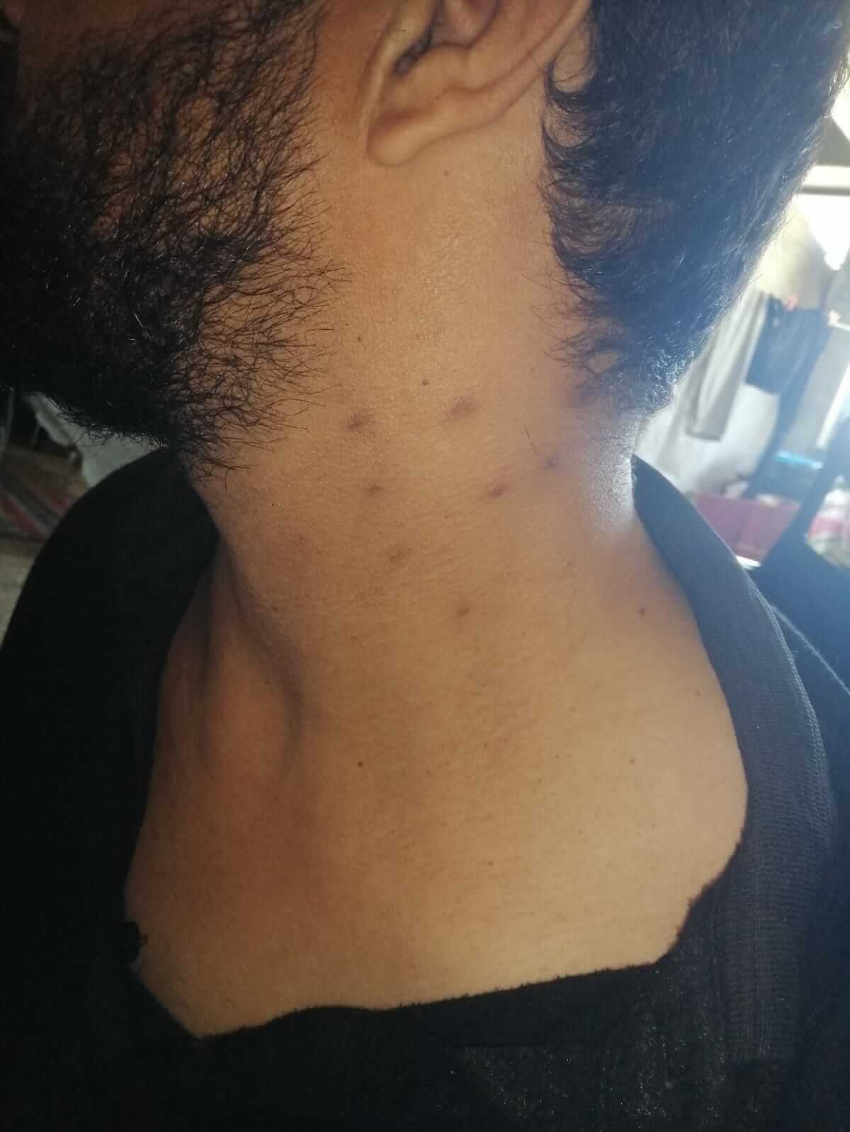 issa-neck(1).jpg