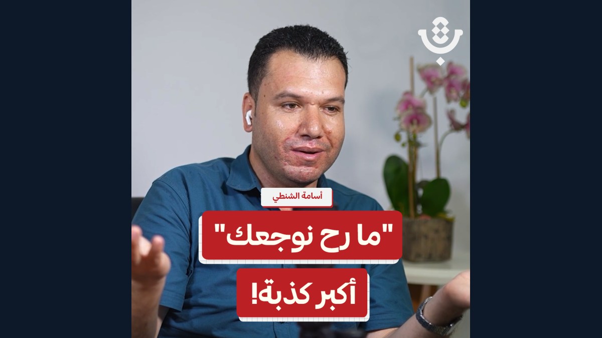 لماذا نكره أطباء الأسنان؟ | أسامة الشنطي | 227